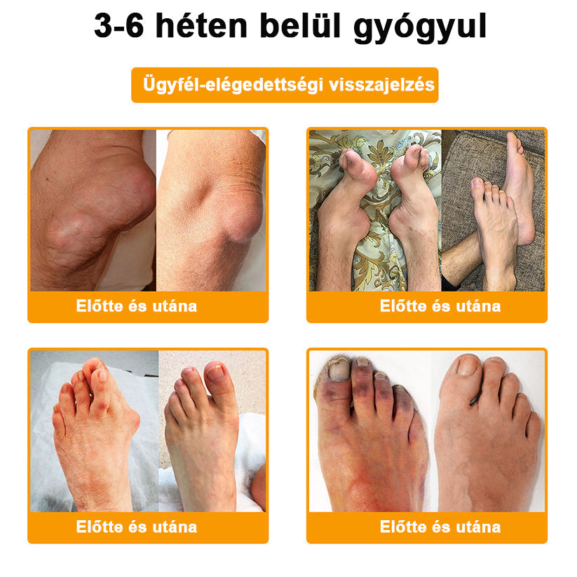 💧🐝ADNOON® Botulinum Toxin & Méhméreg Fájdalomcsillapító Csontgyógyító Krém👨⚕️A Magyar Ortopéd Társaság (MOT) Által Jóváhagyva