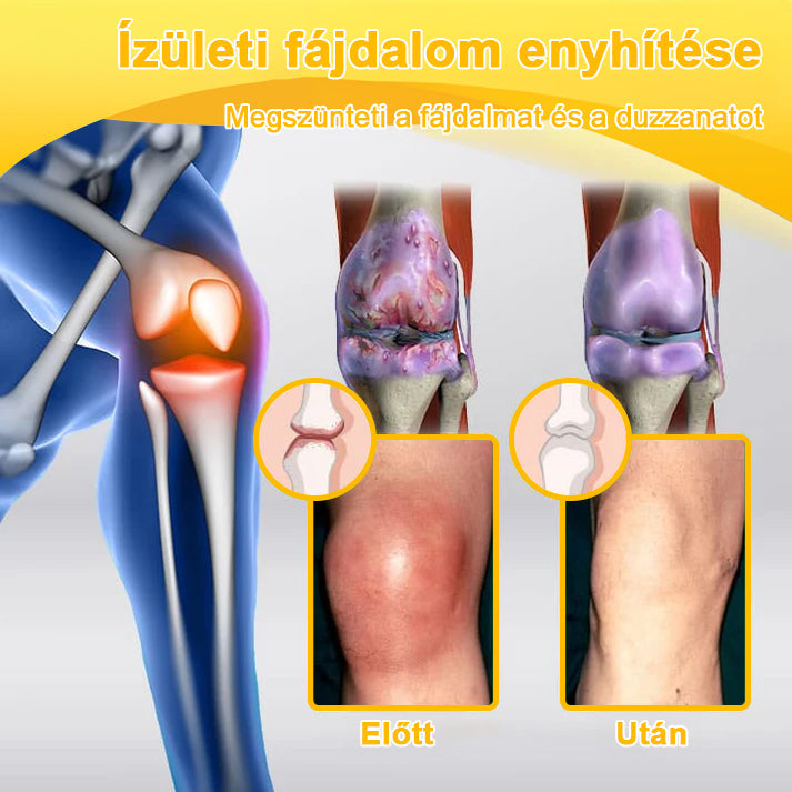 💧🐝ADNOON® Botulinum Toxin & Méhméreg Fájdalomcsillapító Csontgyógyító Krém👨⚕️A Magyar Ortopéd Társaság (MOT) Által Jóváhagyva