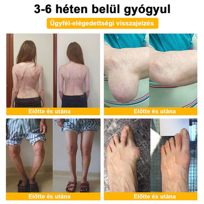 💧🐝ADNOON® Botulinum Toxin & Méhméreg Fájdalomcsillapító Csontgyógyító Krém👨‍⚕️A Magyar Ortopéd Társaság (MOT) Által Jóváhagyva