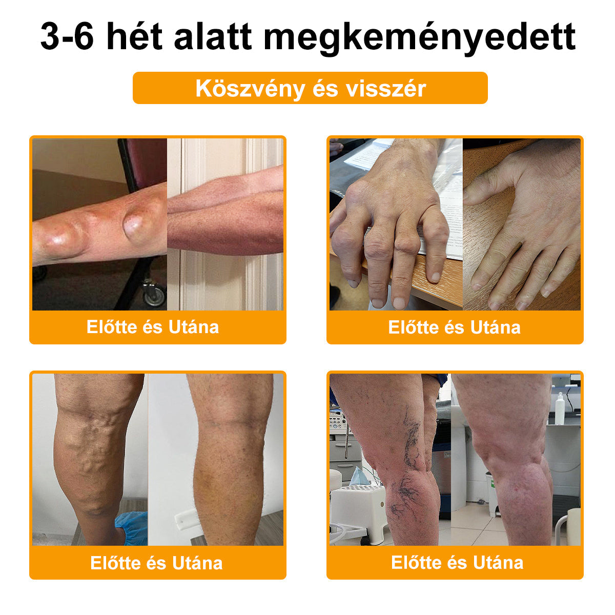 🔥🎁 Már csak 5 doboz maradt! További 50%-os kedvezményt kínálunk! Szerezzétek vissza az alakotokat és egészségeteket. Most veszítsetek, és nem lesz több lehetőség jövő évig.