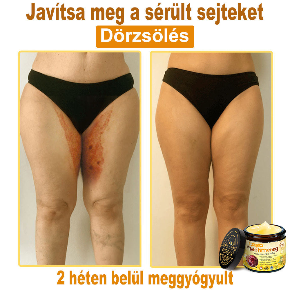 🐝🎁 Már csak 5 doboz maradt! További 50%-os kedvezményt kínálunk! Szerezzétek vissza az alakotokat és egészségeteket. Most veszítsetek, és nem lesz több lehetőség jövő évig.