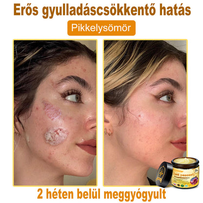 🐝🎁 Már csak 5 doboz maradt! További 50%-os kedvezményt kínálunk! Szerezzétek vissza az alakotokat és egészségeteket. Most veszítsetek, és nem lesz több lehetőség jövő évig.