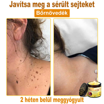 🐝🎁 Már csak 5 doboz maradt! További 50%-os kedvezményt kínálunk! Szerezzétek vissza az alakotokat és egészségeteket. Most veszítsetek, és nem lesz több lehetőség jövő évig.