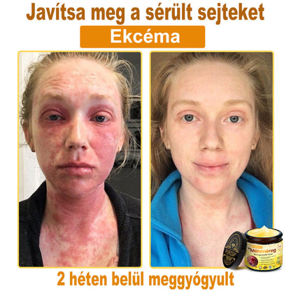 🐝🎁 Már csak 5 doboz maradt! További 50%-os kedvezményt kínálunk! Szerezzétek vissza az alakotokat és egészségeteket. Most veszítsetek, és nem lesz több lehetőség jövő évig.