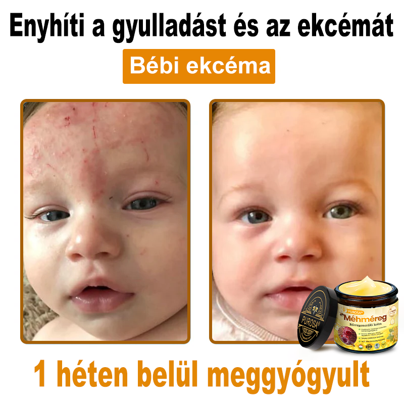 🐝🎁 Már csak 5 doboz maradt! További 50%-os kedvezményt kínálunk! Szerezzétek vissza az alakotokat és egészségeteket. Most veszítsetek, és nem lesz több lehetőség jövő évig.