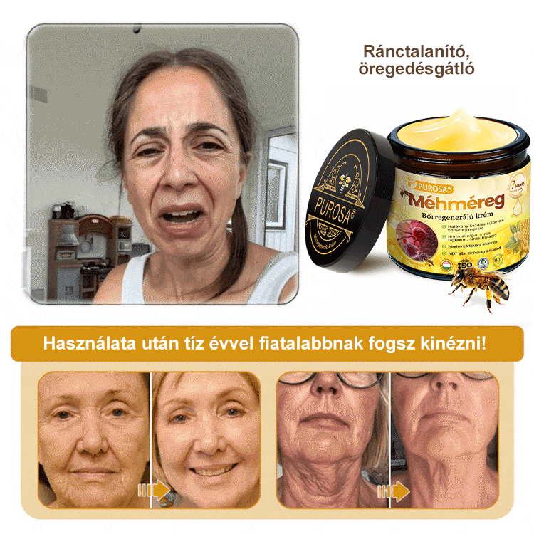 🐝🎁 Már csak 5 doboz maradt! További 50%-os kedvezményt kínálunk! Szerezzétek vissza az alakotokat és egészségeteket. Most veszítsetek, és nem lesz több lehetőség jövő évig.