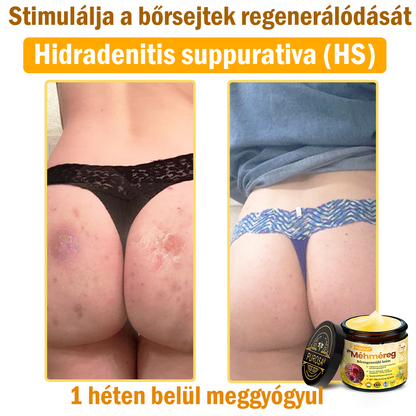 🐝🎁 Már csak 5 doboz maradt! További 50%-os kedvezményt kínálunk! Szerezzétek vissza az alakotokat és egészségeteket. Most veszítsetek, és nem lesz több lehetőség jövő évig.