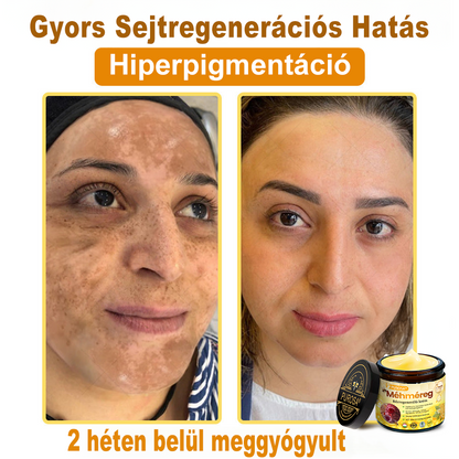 🐝🎁 Már csak 5 doboz maradt! További 50%-os kedvezményt kínálunk! Szerezzétek vissza az alakotokat és egészségeteket. Most veszítsetek, és nem lesz több lehetőség jövő évig.