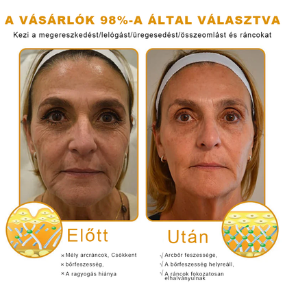🐝🎁 Már csak 5 doboz maradt! További 50%-os kedvezményt kínálunk! Szerezzétek vissza az alakotokat és egészségeteket. Most veszítsetek, és nem lesz több lehetőség jövő évig.