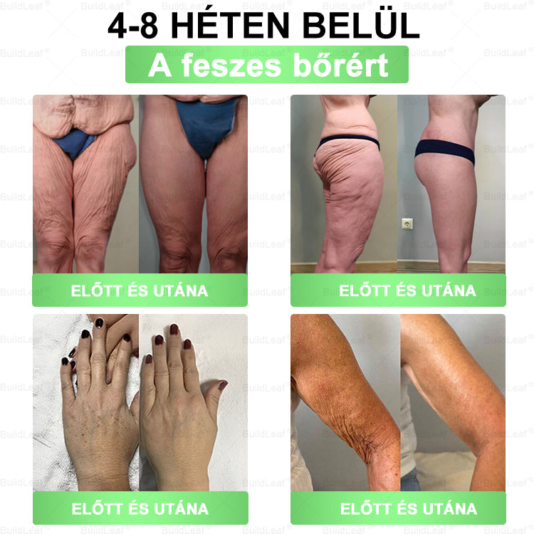 🍀Korlátozott készlet! A BuildLeaf® 🎁 további 30% kedvezményt kínál! Helyezze vissza testét és egészségét. Cselekedjen most – ez a lehetőség nem tart sokáig.