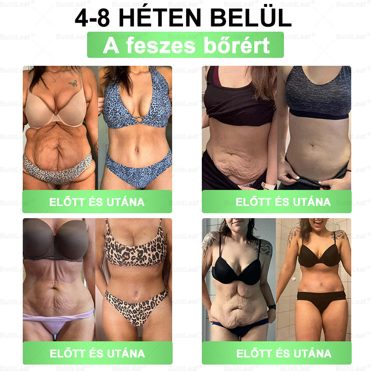 🍀Korlátozott készlet! A BuildLeaf® 🎁 további 30% kedvezményt kínál! Helyezze vissza testét és egészségét. Cselekedjen most – ez a lehetőség nem tart sokáig.